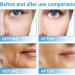 Face Serum for Women - 15% Niacinamide Serum - Hyaluronic Acid Serum for Face - Dark Spot Correcting Glow Serum - Moisturizing Collage Face Serum - Reduce Acne Nourish - Buy Online on GoSupps.com