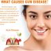 Ampulls Tooth Serum & Gum Repair Essence - Whitening & Repair Cure Ampoules | Shop Internationally - Buy Online on GoSupps.com