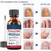 Fungal Nail Treatment Premium Fungal Nail Eliminator Toenail Treatment Extra Strong Nail Repair Anti fungus Nail Repair and Strengthen Fix & Renew Damaged Broken Nails - Buy Online on GoSupps.com