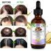 SIKOT Hair Growth Oil With Rosemary Oil Castor Oil Batana Oil and Coconut Oil Mixed Hair Growth Oil to Help Hair Grow Hair Oil for Helps to Grow Hair Strengthen Hair and Get Healthy Scalp - 60ML - Buy Online on GoSupps.com
