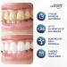 Premium Peroxide-Free Teeth Whitening Strips - 21 Sessions for Deep Stain Removal and Enamel-Safe Results - Buy Online on GoSupps.com