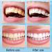 SHUBEIEUMI Tartar Remover - 3 Pack Professional Teeth Cleaning Brush for Stain & Discoloration Removal - Fast International Shipping - Buy Online on GoSupps.com