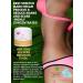 Best Stretch Marks Cream - Prevent & Reduce Pregnancy Marks | Highly Concentrated Formula + Free $29 Scar Reducing Guide - International Shipping Available - Buy Online on GoSupps.com