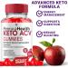 Perma Health Gummies PermaHealth Keto ACV Gummies Perma Health Apple Cider Vinegar Weight Management Support Supplement Perma Health Canada Max Strength Health Support Gummy Formula (60 Gummies) - Buy Online on GoSupps.com