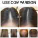 Hair Growth Spray Hair Growth Oil with Biotin Hair Thickening Spray Nourishes Hair & Scalp Anti Hair Loss Serum for Thicker Longer & Stronger Hair 30ML - Buy Online on GoSupps.com