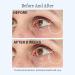 StriVectin Contour Restore Firming Moisture Balm for Eyes 0.5 oz - Anti-Aging Eye Cream - Buy Online on GoSupps.com
