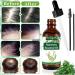 Rosemary Oil for Hair Growth 60ml | Nourishing Essential Oil for Scalp Massage | Bio Rosemary Oil for Men and Women - Buy Online on GoSupps.com