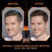 L'Oreal Paris Men Expert One Twist Mess Free Dark Brown Hair Color - Ammonia Free, Covers Grays, Easy Application - 1 Kit - Buy Online on GoSupps.com