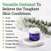Remedy Tea Tree Oil Balm - Natural Cream for Athlete's Foot, Jock Itch, Eczema, Nail Issues & Skin Irritation - 2 Oz - Buy Online on GoSupps.com