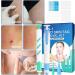 Jomewory Auto Tags Removal Kit - Effective Dog Skin Tags Remover | Pen and Bands for Warts (Small to Large) - Fast International Shipping - Buy Online on GoSupps.com