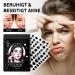 Shefave Pimple Patch 108pcs - Cute Black Acne Patches for Day & Night Care | Hydrocolloid Facial Treatment for Fast Pimple Relief - Buy Online on GoSupps.com