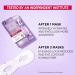 L'Oreal Paris Revitalift Filler Hyaluronic Acid and Caffeine Plumping and Brightening Eye Sheet Mask - Buy Online on GoSupps.com