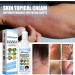 ZOOICY Meellop Herbal Psoriasis Relief Spray - 2pcs - Buy Online on GoSupps.com