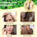 100% Pure Peppermint Oil for Hair Growth - Essential Oil for Diffuser with Dropper | Shop Internationally - Buy Online on GoSupps.com