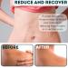 Reusable Silicone Scar Sheets for Surgical Scars | Pack of 4 | Soft Silicone Scar Removal Tape for C-Section Keloid & Burn Scars - Travel Size 1.6 x 3 Inches - Buy Online on GoSupps.com