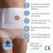 TYTEX White XL Belt - Maximum Stoma & Hernia Support Compression | International Shipping Available - Buy Online on GoSupps.com