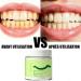 Collagen Powder for Gums Collagen for Gums Colageno Gingival Collagen for Teeth Smile Strengthening Collagen Tooth Powder Tooth Repair Kit Hydroxyapatite Toothpaste Care Powders Protect Gum (2Set) - Buy Online on GoSupps.com
