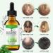 Rosemary Essential Oil for Hair Growth & Skin Care - 60ml | Promotes Hair Growth, Nourishes Scalp, Eyebrow, and Eyelash Growth - Men and Women - Buy Online on GoSupps.com