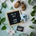 Teddio Baby Rattle Teething Toy | Smooth Wooden Easy Grip Ring | Gender Neutral Baby Gift with Koala Design - Buy Online on GoSupps.com
