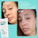 Super Facialist Clear Out Clarifying Mask - Acne Treatment & Blackhead Remover Face Mask with 1% Niacinamide Tea Tree Oil & Prebiotics Vegan Friendly 125ml - Buy Online on GoSupps.com