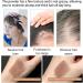 Instantly Hairline Powder Hair Root Dye Fill Forehead Root Concealer Instantly Conceals Hair Windproof Sweat-Proof Hair Touch-Up for Natural Looking 27.5g Dark Brown - Buy Online on GoSupps.com