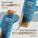 Head & Shoulders Royal Oils Shampoo & Conditioner Set - Anti-Dandruff Scalp Care - Curly & Coily Hair Treatment - Buy Online on GoSupps.com