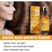 Tongyend Castir Oil Hair Growth Oil Castir Essential Oil Ginger Oil for Hair Growth Rosemary Hair Growth Oil Improve Hair Loss & Nourishes for Women Men-50ML - Buy Online on GoSupps.com