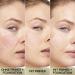 L'Or al Paris Redness Eraser Primer - Long-Lasting Make-Up Base Conceals Redness 24-Hour Wear - 30ml - Buy Online on GoSupps.com