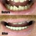 Instant Smile Comfort Fit Flexible Lower Teeth - Easy Teeth Alignment Solution - Buy Online on GoSupps.com