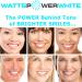Watts Power 35% Dual Action Teeth Whitening Gels - 4 Huge 10ml Gels + Aftercare Gel - Made in the USA - Kosher Mint - Quick Results - Buy Online on GoSupps.com