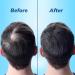 MCG Hair Loss Treatment Mousse for Men and Women - Procapil Biotin Formula - No Minoxidil Side Effects - Hair Thickening Products - 75ml - Buy Online on GoSupps.com