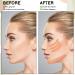 4 Rolls Face Lift Tape - Overnight Wrinkle Reduction Patches for Forehead Face & Neck | 2.5cm x 5m | Global Shipping Available - Buy Online on GoSupps.com