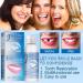Tooth Repair Granules | Temporary Dental Repair Kit for Broken Teeth | Thermal Fitting Beads | 2PC Tooth Filling Repair Kit - Buy Online on GoSupps.com