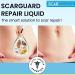 Scarguard Scar Treatment with Silicone & Vitamin E - 0.5 oz - For New & Old Scars - Buy Online on GoSupps.com