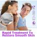 Azelaic Acid Serum Cream Brightening Face Skin Care Treatment for All Skin Types 20G 20 g (Pack of 1) - Buy Online on GoSupps.com
