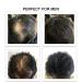 Febron Hair Fibers Dark Brown 30g - Hair Loss Concealer for Men & Women - Volumizing & Undetectable Bald Spot Filler - 100% Natural - 1.06oz Pack - Buy Online on GoSupps.com