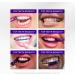 Hismile V34 Whitening Strips Teeth Whitening Strips Purple Tooth Whitening Purple V34 Whitening Strips Tooth Stain Treatment Combining Whitening and Colour Correction 1 Count (Pack of 14) - Buy Online on GoSupps.com