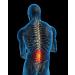 Bodi-Tek R ckendehner Backmagic Plus - Ergonomic Back Stretch Device for Pain Relief | Buy Internationally - Fast Shipping - Buy Online on GoSupps.com