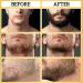 Premium Beard Butter for Men - Hydrating Moisturizer & Mustache Balm | Softens Facial Hair & Promotes Growth - 1 fl oz - Buy Online on GoSupps.com