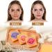 Buy Kojic Acid Soap - Dark Spot Remover & Turmeric Soap Bar (6 Pack) | Vitamin C Hyaluronic Acid Even Tone Skin - Buy Online on GoSupps.com