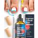 Dr. Krause Ingrown Toenail Treatment Kit - 2 Gel Toe Caps & Toenail File & Best Ingrown Toenail Pain Reliever 0.5oz & Toenail Softener for Easy Trimming - Essential Oil Drops w Tea Tree Oil
