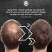 MANE Hair Thickening Spray & Root Touch Up Seal & Control Combo Pack Instantly Thicker Hair for Men & Women Fill in Hairlines and Hide Thinning and Fine Patches - Gray 12 Colors (6.76 oz) Grey - Buy Online on GoSupps.com