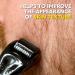Buy The Beard Club Derma Roller - Microneedling Roller for Face Body & Scalp - 540 Titanium Microneedles for Hair & Beard - International Shipping Available - Buy Online on GoSupps.com
