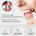 REMOS Tooth Eraser & Dental Mirror Set | Superior Oral Hygiene Tool Against Plaque | Ships Worldwide - Buy Online on GoSupps.com