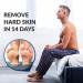 Exfoliating Foot Peel Mask for Baby Soft Feet - Dermatologically Tested, 2 Pairs (up to Size 12) - Buy Online on GoSupps.com