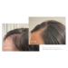 Virtue Flourish 100% Drug-Free Hair Growth Regimen - 3 Month Kit for Healthy Hair | International Shipping Available - Buy Online on GoSupps.com