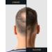 JP Confidence Premium Scatter Hair - 100% Natural Dark Brown Hairdressing Quality for Men & Women - Authentic Look Ideal for Hair Compression - Buy Online on GoSupps.com