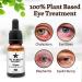 Chalazion & Blepharitis Treatment - Stye Eye Remover (15 ml) | Made in USA - Buy Online on GoSupps.com