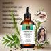 SAMS Rosemary Mint Hair Growth Oil - Organic Scalp Treatment for Fast Hair Growth | Strengthens & Nourishes Prevents Breakage 2 fl oz - Buy Online on GoSupps.com